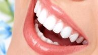 برای داشتن دندان‌های سفید از این روش ها استفده کنید