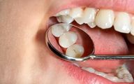 دارویی که با مصرف آن دوباره دندان‌ها رشد می‌کنند!