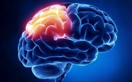 درمانی جدید برای مبارزه با سرطان مغز