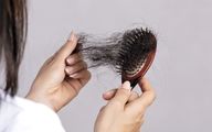 چند روش آسان و ارزان برای کاهش ریزش مو